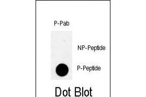 Dot blot analysis of anti-Phospho-Rad9- Antibody (ABIN389633 and ABIN2839629) on nitrocellulose membrane. (RAD9A Antikörper  (pSer328))