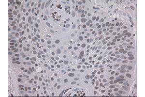 Immunohistochemical staining of paraffin-embedded colon using anti-STAT3 (ABIN2452542) mouse monoclonal antibody. (STAT3 Antikörper  (AA 154-175))