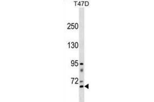 Western Blotting (WB) image for anti-Rhophilin, rho GTPase Binding Protein 2 (RHPN2) antibody (ABIN3000839) (RHPN2 Antikörper)
