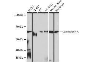 Western blot analysis of extracts of various cell lines, using Calcineurin A Rabbit mAb (ABIN7269692) at 1:1000 dilution. (PPP3CA Antikörper)