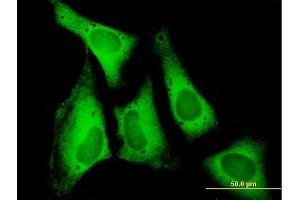 Immunofluorescence of purified MaxPab antibody to EIF5B on HeLa cell. (EIF5B Antikörper  (AA 1-1220))
