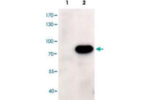 HEK293 overexpressing human ABCD1 and probed with ABCD1 polyclonal antibody  at 1ug/ml (mock transfection in first lane).