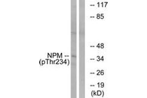 Western blot analysis of extracts from HeLa cells treated with nocodazole 1ug/ml 18h, using NPM (Phospho-Thr234) Antibody. (NPM1 Antikörper  (pThr234))
