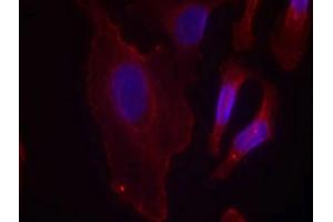 Immunofluorescence staining of methanol-fixed Hela cells using PLCg2(Phospho-Tyr753) Antibody. (Phospholipase C gamma 2 Antikörper  (pTyr753))