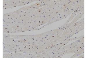 ABIN6274297 at 1/100 staining Mouse heart tissue by IHC-P. (DLX5 Antikörper  (Internal Region))