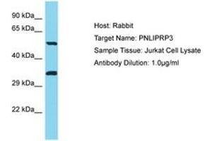 Image no. 1 for anti-Pancreatic Lipase-Related Protein 3 (PNLIPRP3) (AA 389-438) antibody (ABIN6750748) (PNLIPRP3 Antikörper  (AA 389-438))
