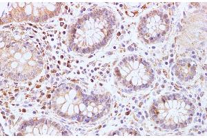 Immunohistochemistry (Paraffin-embedded Sections) (IHC (p)) image for anti-Breast Cancer 2, Early Onset (BRCA2) antibody (ABIN7234156)
