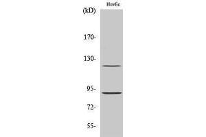 Western Blotting (WB) image for anti-PR (pSer190) antibody (ABIN3172967) (PR (pSer190) Antikörper)