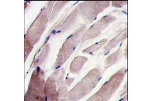 Formalin-fixed and paraffin-embedded human skeletal muscle tissue reacted with the P38 gamma antibody (C-term), which was peroxidase-conjugated to the secondary antibody, followed by DAB staining. (MAPK12 Antikörper  (C-Term))