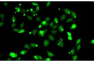 Immunofluorescence analysis of HeLa cells using C1S Polyclonal Antibody (C1S Antikörper)