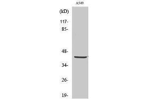 Western Blotting (WB) image for anti-Pyruvate Dehydrogenase (Lipoamide) alpha 1 (PDHA1) (C-Term) antibody (ABIN3186372) (PDHA1 Antikörper  (C-Term))