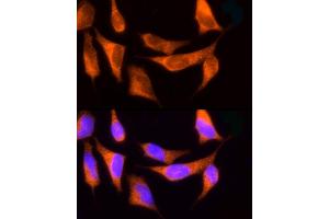 Immunofluorescence analysis of HeLa cells using ROCK2 Rabbit pAb (ABIN6129455, ABIN6147068, ABIN6147069 and ABIN6221359) at dilution of 1:150 (40x lens). (ROCK2 Antikörper  (AA 1109-1388))