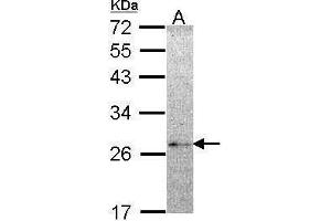 WB Image Sample (30 ug of whole cell lysate) A: Hela 12% SDS PAGE NME5 antibody antibody diluted at 1:1000 (NME5 Antikörper  (Center))