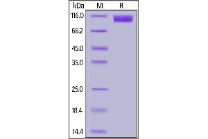 SARS S1 protein, His Tag on SDS-PAGE under reducing (R) condition. (SARS-CoV S1 Protein (His tag))