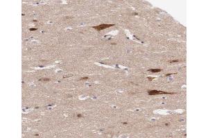ABIN6267316 at 1/200 staining human brain tissue sections by IHC-P.