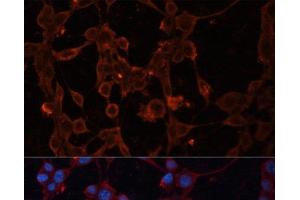 Immunofluorescence analysis of NIH/3T3 cells using SLC25A27 Polyclonal Antibody at dilution of 1:100. (SLC25A27 Antikörper)
