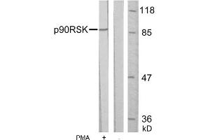 Image no. 1 for anti-Ribosomal Protein S6 Kinase, 90kDa, Polypeptide 1 (RPS6KA1) (Ser352) antibody (ABIN197331) (RPS6KA1 Antikörper  (Ser352))