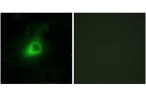 Immunofluorescence analysis of HeLa cells, using GRK6 Antibody. (GRK6 Antikörper  (AA 10-59))