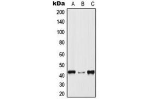 Western blot analysis of p38 expression in HeLa (A), Raw264. (MAPK14 Antikörper  (Center))