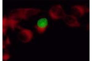 Immunofluorescence (IF) image for anti-Herpes Simplex Virus Type 1 ICP4 (HSV1 ICP4) antibody (ABIN265556) (HSV1 ICP4 Antikörper)