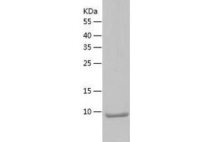 Western Blotting (WB) image for Chemokine (C-C Motif) Ligand 7 (CCL7) (AA 24-99) (Active) protein (His tag) (ABIN7122311)
