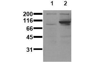 Western Blotting (WB) image for anti-Signal Transducer and Activator of Transcription 6, Interleukin-4 Induced (STAT6) (pTyr641) antibody (ABIN126901) (STAT6 Antikörper  (pTyr641))