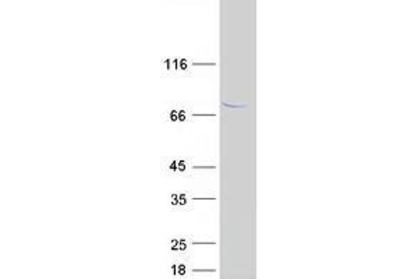 TTC30A Protein (Myc-DYKDDDDK Tag)