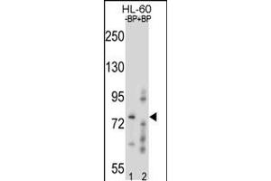 Western blot analysis of RNF40 Antibody Pab pre-incubated without(lane 1) and with(lane 2) blocking peptide in HL-60 cell line lysate. (RNF40 Antikörper  (C-Term))