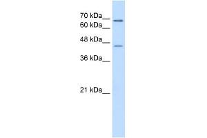 ALDH3A2 antibody used at 0. (ALDH3A2 Antikörper  (C-Term))