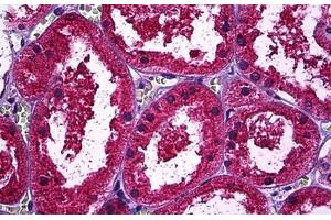 Human Kidney, Tubules: Formalin-Fixed, Paraffin-Embedded (FFPE) (Osteopontin Antikörper)