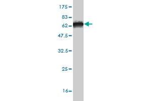 Western Blotting (WB) image for anti-Inositol-Tetrakisphosphate 1-Kinase (ITPK1) (AA 1-314) antibody (ABIN561564)