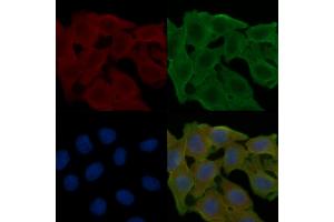 ABIN6258013 and ABIN6274979 staining Hela cells(24h of starvation treatment) by IF/ICC. (CDC42EP2 Antikörper  (N-Term))
