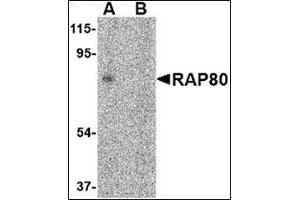 Western blot analysis of RAP80 in 293 cell lysate in (A) the absence and (B) presence of blocking peptide with this product at 2 μg/ml. (UIMC1 Antikörper  (C-Term))