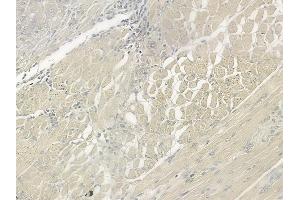 ABIN6266286 and ABIN6277442 at 1/100 staining human tongue carcinoma by IHC-P. (TRIM63 Antikörper  (N-Term))