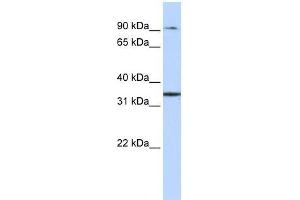 ZFP90 antibody used at 0. (ZNF90 Antikörper  (Middle Region))
