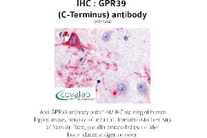 Image no. 1 for anti-G Protein-Coupled Receptor 39 (GPR39) (C-Term) antibody (ABIN1735081) (GPR39 Antikörper  (C-Term))