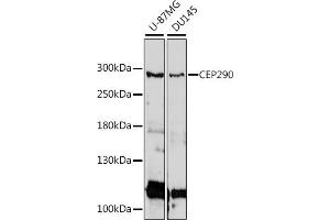 Western blot analysis of extracts of various cell lines, using CEP290 antibody (ABIN7266277) at 1:1000 dilution. (CEP290 Antikörper  (AA 950-1050))