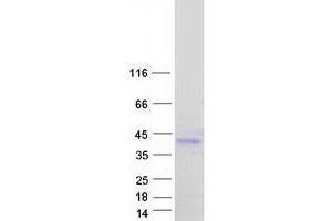 Validation with Western Blot
