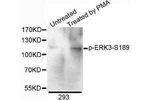 Western blot analysis of extracts of 293 cells, using Phospho-ERK3-S189 antibody. (MAPK6 Antikörper  (pSer189))