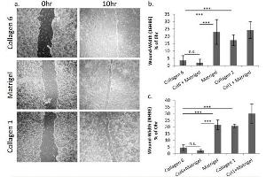 Image no. 7 for Collagen, Type VI (COL6) protein (ABIN5624600)