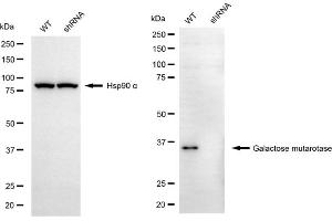 Western blotting analysis using galactose mutarotase antibody (ABIN7798681). (GALM Antikörper)