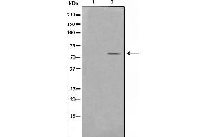 Western blot analysis on HuvEc cell lysate using Pim-1 Antibody，The lane on the left is treated with the antigen-specific peptide.