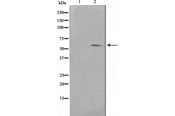 PIM1 antibody  (Internal Region)
