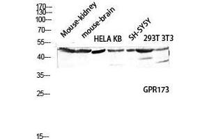 Western Blot (WB) analysis of Mouse Kidney Mouse Brain HeLa KB SH-SY5Y 293T 3T3 lysis using GPR173 antibody. (GPR173 Antikörper  (Internal Region))