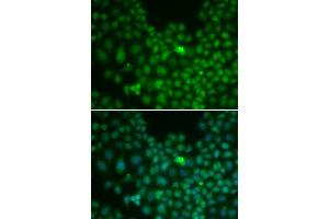 Immunofluorescence (IF) image for anti-Clusterin (CLU) (AA 220-449) antibody (ABIN6138757)