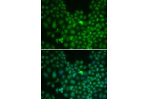 Immunofluorescence analysis of U2OS cells using Clusterin alpha chain antibody (ABIN6133478, ABIN6138757, ABIN6138759 and ABIN6217494). (Clusterin Antikörper  (AA 220-449))