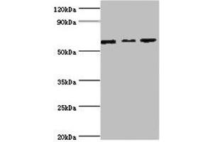 Western blot All lanes: MAPK4 ntibody at 6 μg/mL Lane 1: Mouse brain tissue Lane 2: 293T whole cell lysate Lane 3: Jurkat whole cell lysate Secondary Goat polyclonal to rabbit IgG at 1/10000 dilution Predicted band size: 66 kDa Observed band size: 66 kDa (MAPK4 Antikörper  (AA 348-587))