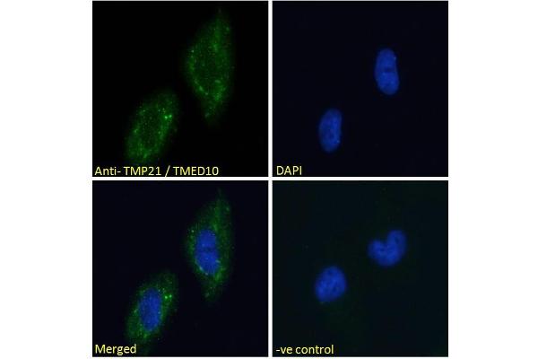 TMED10 Antikörper  (C-Term)