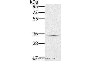 Western blot analysis of Hela cell, using NDUFA9 Polyclonal Antibody at dilution of 1:400 (NDUFA9 Antikörper)