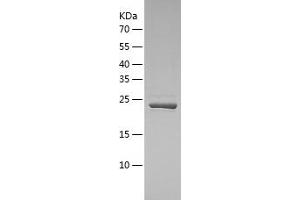 Western Blotting (WB) image for Cell Division Cycle 34 (CDC34) (AA 1-236) protein (His tag) (ABIN7122230) (CDC34 Protein (AA 1-236) (His tag))